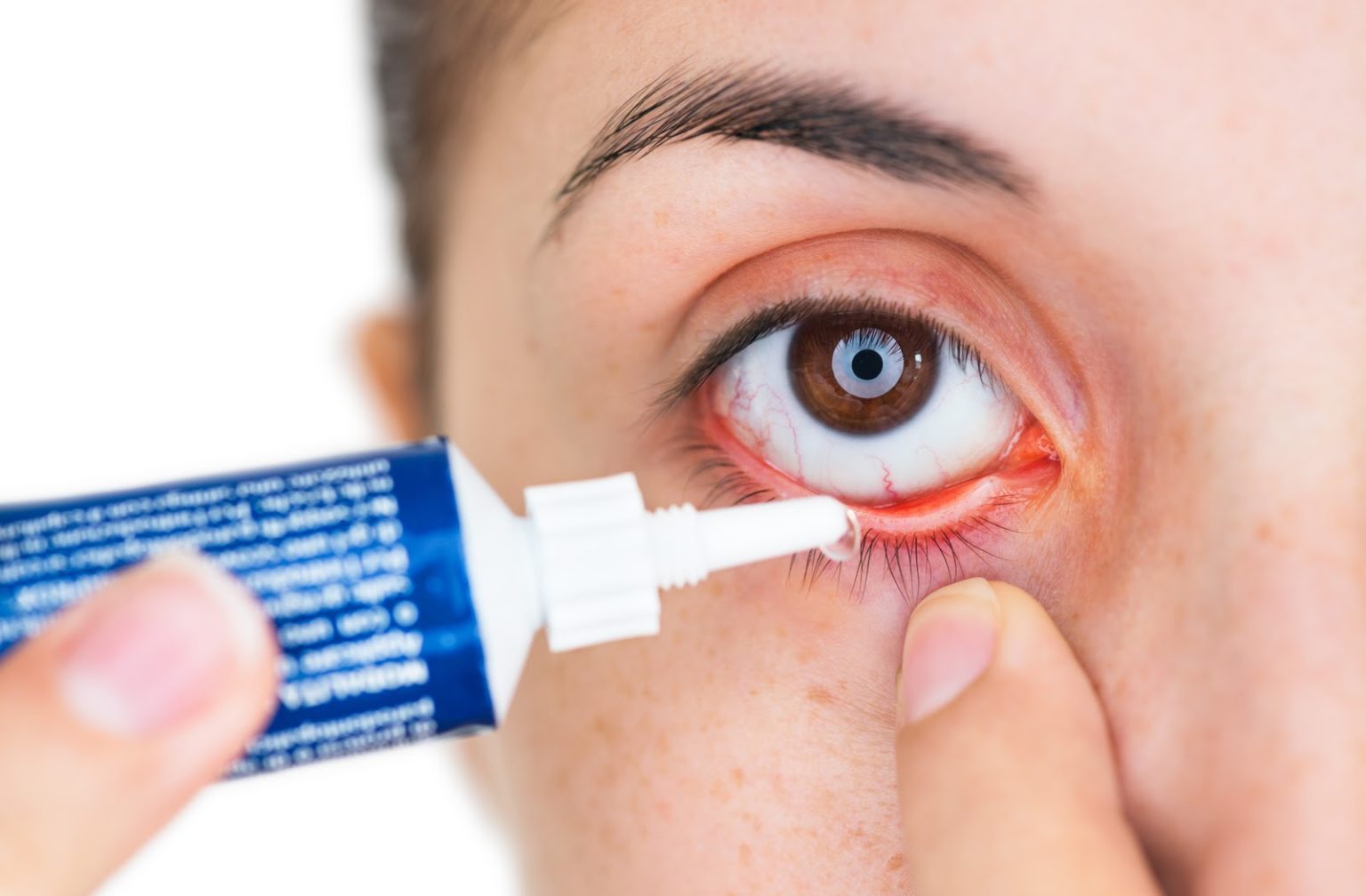 Eye Drops vs. Gel vs. Ointment What’s the Difference?